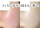 ベルリール 浜松店(BELRIR)の写真