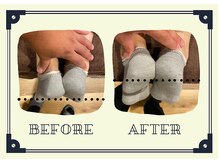 整体院プリュ/Before→ After［20］