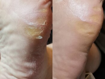 ラウン Nail salon Roun/ドイツ式フットケア