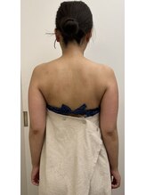 リバース(Rebirth)/二の腕背中スリミング・ビフォー