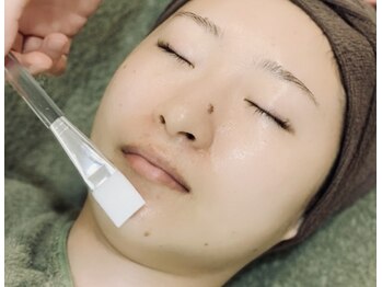 ディアローグ(Dialogue)/酸ピーリング