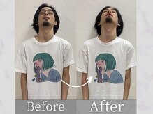 タケダ整体院/首の痛み＆腕のしびれの改善事例