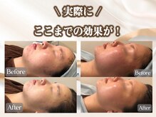 ビューティースタジオ韓美 池袋店の雰囲気（お客様のお悩みに合わせた施術を提供いたします♪<池袋/水光肌>）