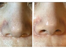 リアン(凛晏)/ビフォーアフター