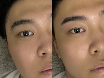 眉毛男子 池袋店の写真/《池袋駅徒歩1分》低価格で通いやすさ◎4000以下のメニューあり!!メンズ美容はお任せください♪