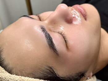 オンリィケア 近大前(ONLY CARE)の写真/《毛穴・ニキビ・青ひげ・肌荒れ・ベタつき…“清潔感を上げたい”あなたへ》