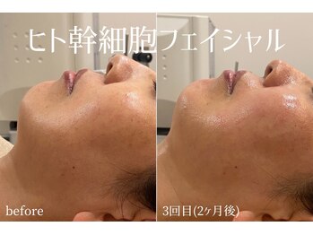 ハティア(hattia)/肌細胞イキイキ生み出すハリ艶up