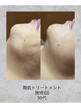 コンクパール(CONCH PEARL.)/陶肌トリートメント