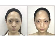 小顔整体研究所 KSラボ 藤が丘店/