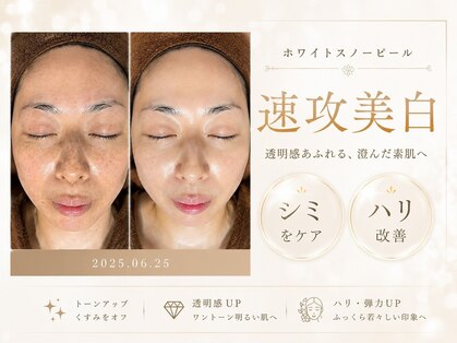 コルッソ(CoLusson.)の写真