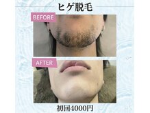 ディシェーレ アストの雰囲気（効果◎メンズひげ脱毛￥10000→）