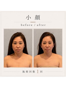 サロン ド ハーモニー美の写真/他店でご満足いただけなかった方はぜひご来店ください