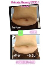 ルアナ(Luana)/脂肪冷却ダイエット！！