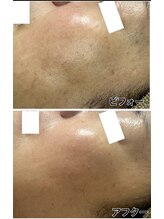 アンジェーム(angeame)/韓国人のような水光肌へ♪