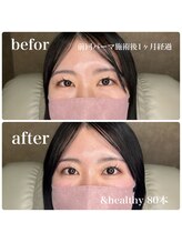 イロ(IRO)/&healthy 80本