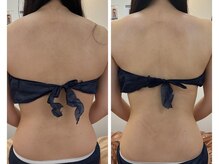 セレア(CELEA)/ブライダル/肩甲骨/華奢/上半身