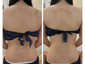 セレア(CELEA)/ブライダル/肩甲骨/華奢/上半身