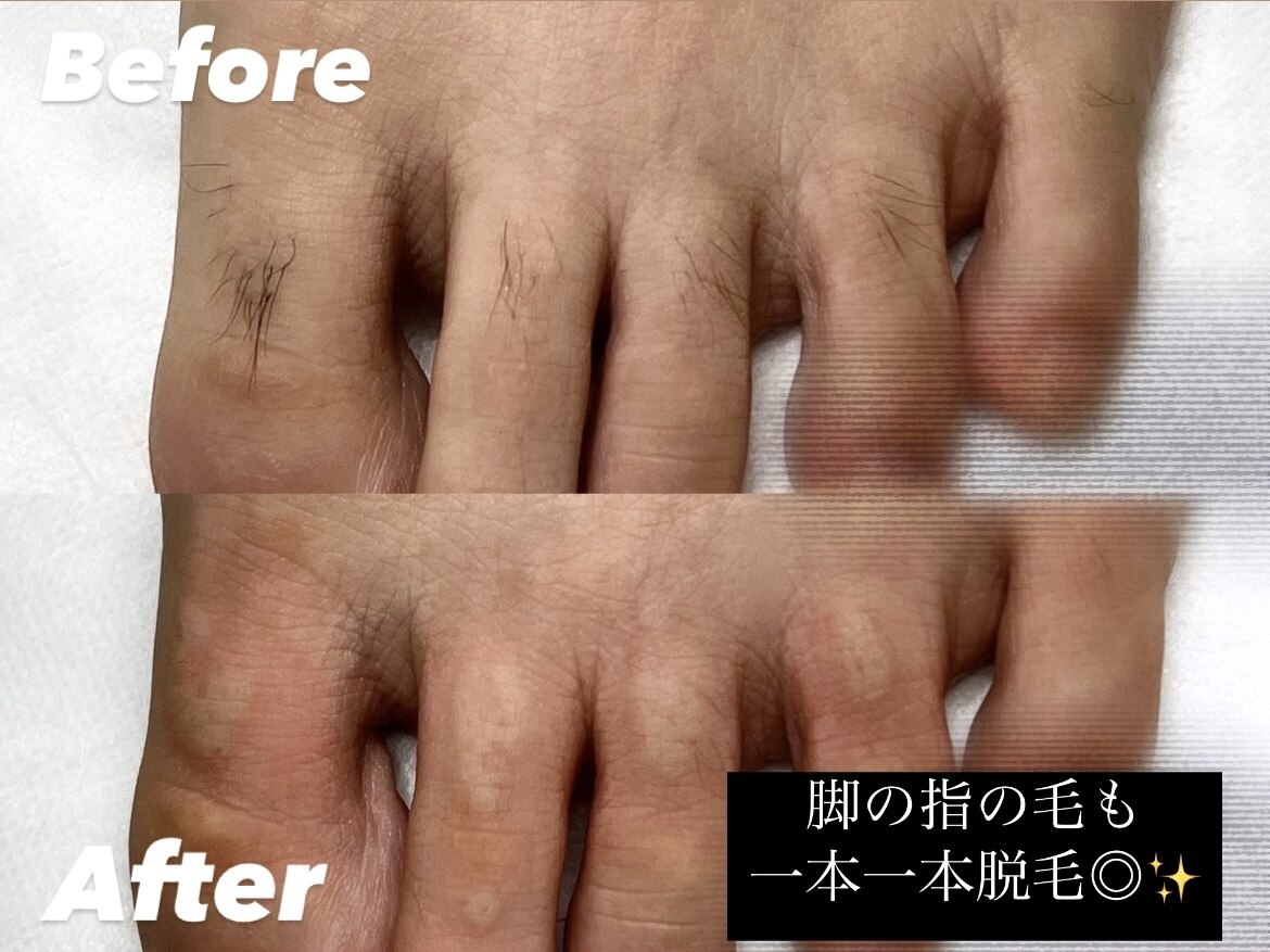 リゼクシー INTERNATIONAL麻布十番 六本木(RESEXXY