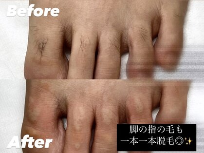 リゼクシー INTERNATIONAL麻布十番 六本木(RESEXXY)の写真
