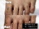 リゼクシー INTERNATIONAL麻布十番 六本木(RESEXXY)の写真