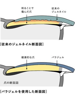 ルチル(Rutile.)/【自爪育成】パラジェル