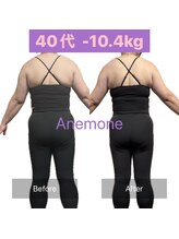 アネモネ/ダイエット/痩身/耳つぼ/腸活