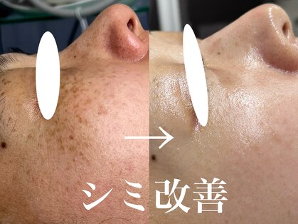 レイ(Rey)の写真