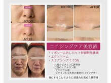 泡のきもち/贅沢な美容成分を存分に吸収