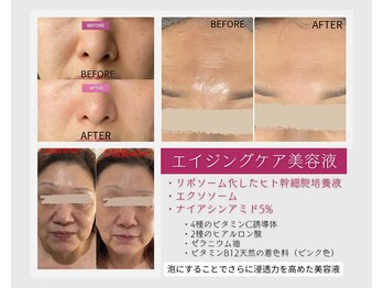 泡のきもち/贅沢な美容成分を存分に吸収