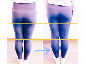 美尻のための矯正×ストレッチサロンPONO FIT.【ポノフィット】/症例／ヒップ