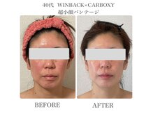 イリゼ(IRISER)の雰囲気（【リフトアップ＆肌質改善】エイジングケア！）