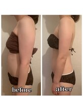 シェノン(CHAINON)/キャビテーション