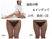 エルール トータルビューティ(Aileure total beauty)