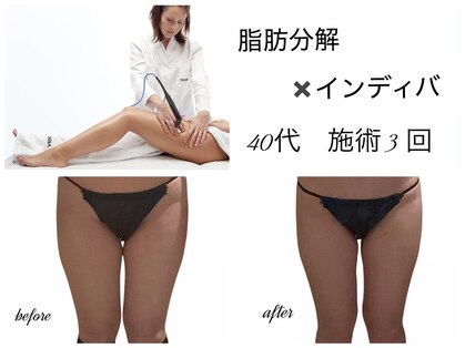 エルール トータルビューティ(Aileure total beauty)の写真