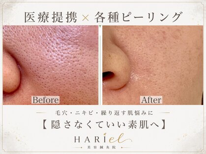 美容鍼灸院ハリエル(HARIel)の写真