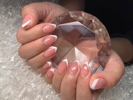 フレンチ☆フィルイン☆オフケア