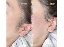 ライフズラッシュ(Lifes lash)/フェイシャルワックス