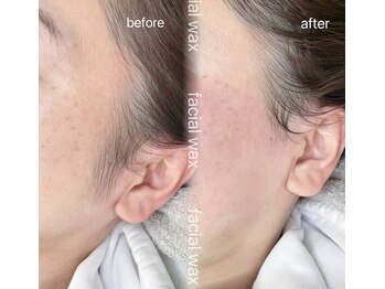 ライフズラッシュ(Lifes lash)/フェイシャルワックス