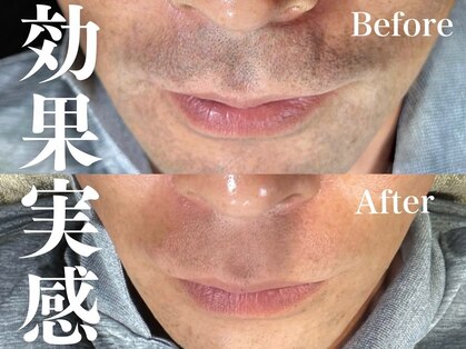 ビーエスの写真