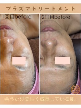 カシェボーテ(CACHE BEAUTE)/肌が綺麗になる