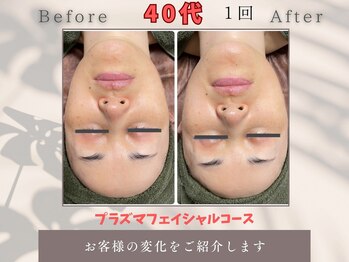 トータルビューティー雅/40代毛穴・乾燥小ジワが気になる