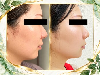 ヨサパーク リリー(YOSA PARK Lily)の写真/冷えは浮腫み、肩こり、疲れなど不調を呼ぶ大敵。最新美容温活で冷えしらずのポカポカ手足に★