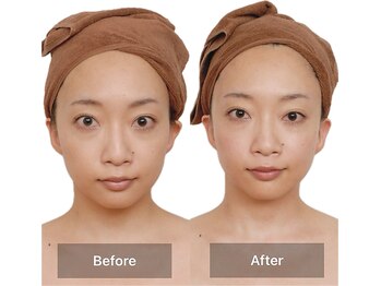サロン ド リアン(salon de lien)/Before /After(1)