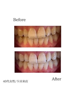 クレン(CLEN)/ブライダルのかたにもオススメ