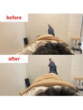 ナオル整体 福岡香椎院(NAORU整体)/40代女性施術事例【股関節】