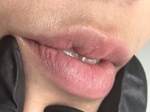 ビービリア(B.villea)