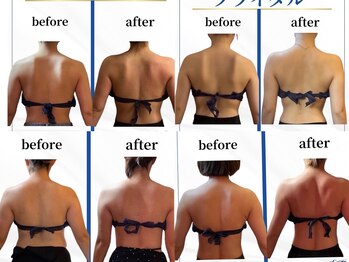 デール(R:DeeL)/得意分野はブライダルエステです