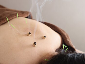 チュラバイユクイ(Chula.byYUKUI)/体の不調に鍼灸施術