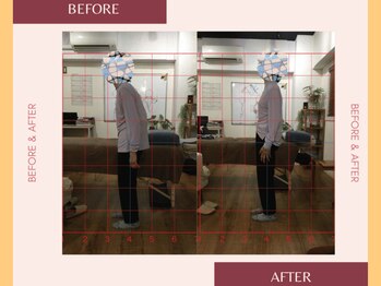 整体院 來花 福岡薬院店(KOHANA)/Bifo/Afuta3 (重度肩こり・腰痛)