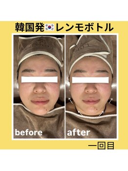 ミツレイ 九条店(MITUREI)/韓国発☆レモンボトル